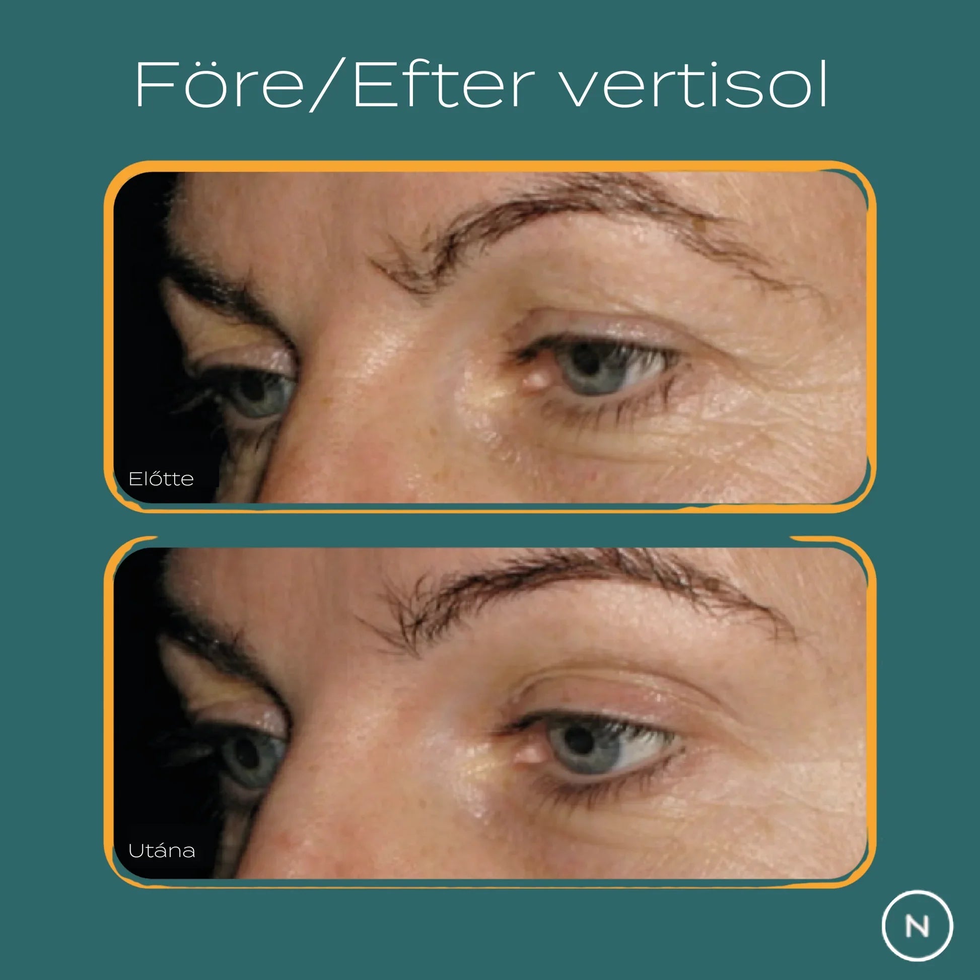 Före vs efter verisol