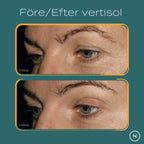 Före vs efter verisol