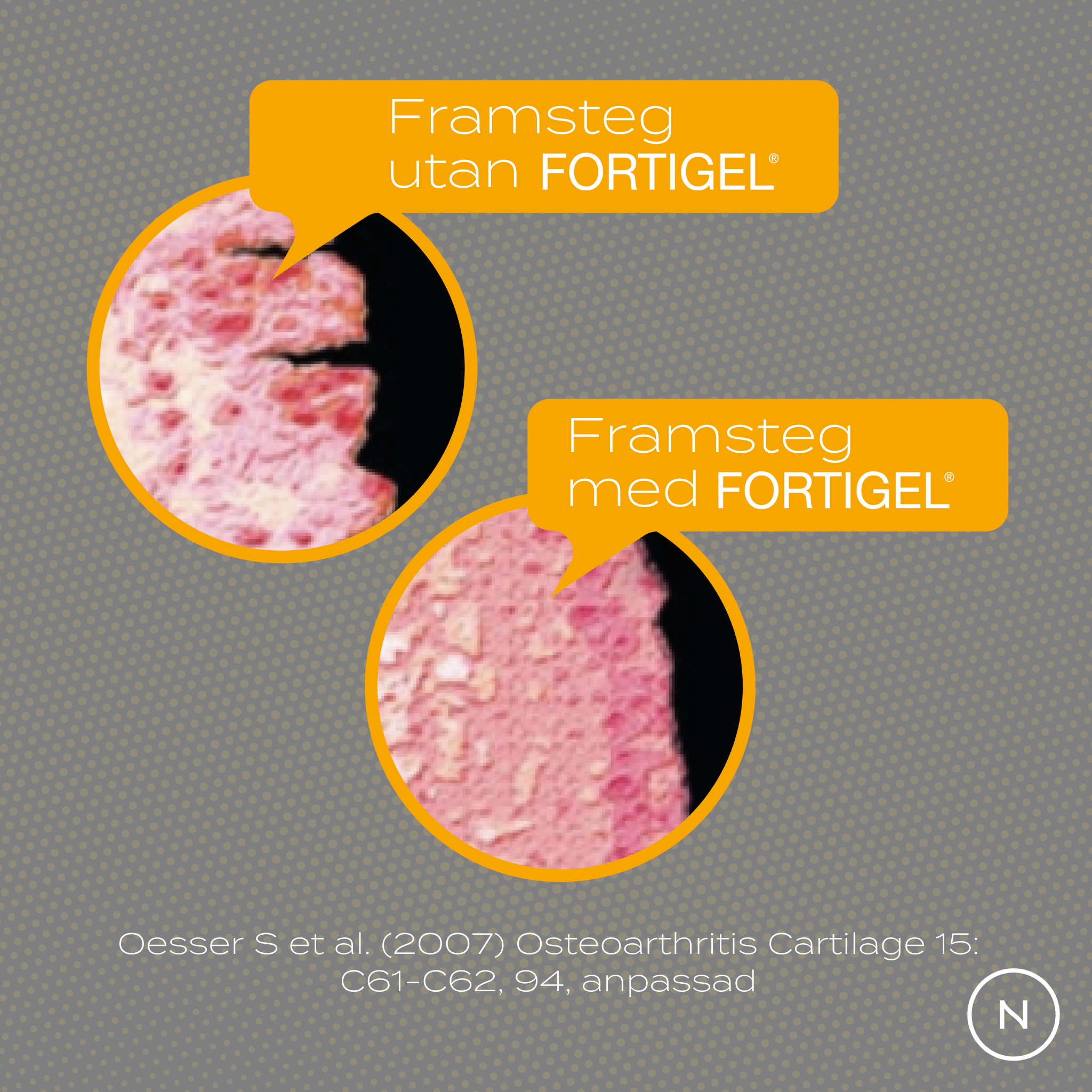 kollagen med och utan fortigel